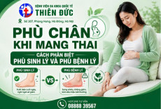 PHÙ CHÂN KHI MANG THAI – CÁCH PHÂN BIỆT PHÙ SINH LÝ VÀ PHÙ BỆNH LÝ