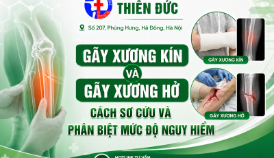 GÃY XƯƠNG KÍN VÀ GÃY XƯƠNG HỞ: CÁCH SƠ CỨU & PHÂN BIỆT MỨC ĐỘ NGUY HIỂM
