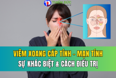 VIÊM XOANG CẤP TÍNH VÀ MẠN TÍNH: SỰ KHÁC NHAU VÀ CÁCH ĐIỀU TRỊ CỦA MỖI LOẠI