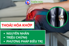 THOÁI HÓA KHỚP (VIÊM XƯƠNG KHỚP): NGUYÊN NHÂN, TRIỆU CHỨNG, VÀ CÁC PHƯƠNG PHÁP ĐIỀU TRỊ HIỆN NAY
