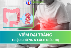 VIÊM ĐẠI TRÀNG: TRIỆU CHỨNG VÀ CÁCH ĐIỀU TRỊ