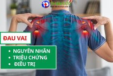 ĐAU VAI: NGUYÊN NHÂN, TRIỆU CHỨNG, CÁC PHƯƠNG PHÁP ĐIỀU TRỊ