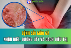 SÙI MÀO GÀ: CÁCH NHẬN BIẾT, ĐƯỜNG LÂY VÀ CÁC PHƯƠNG PHÁP ĐIỀU TRỊ HIỆN ĐẠI