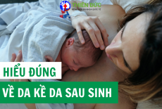 HIỂU ĐÚNG VỀ DA KỀ DA SAU SINH