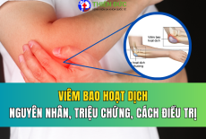 VIÊM BAO HOẠT DỊCH: NGUYÊN NHÂN, TRIỆU CHỨNG VÀ CÁCH ĐIỀU TRỊ HIỆU QUẢ