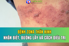 ZONA THẦN KINH: DẤU HIỆU CẢNH BÁO SỚM VÀ NGUY CƠ ĐAU DÂY THẦN KINH SAU ZONA