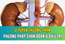U TUYẾN THƯỢNG THẬN: PHƯƠNG PHÁP CHẨN ĐOÁN VÀ ĐIỀU TRỊ