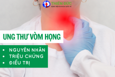 UNG THƯ VÒM HỌNG: NGUYÊN NHÂN, TRIỆU CHỨNG VÀ PHƯƠNG PHÁP ĐIỀU TRỊ