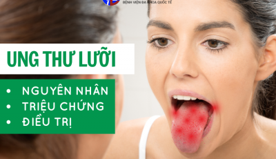 UNG THƯ LƯỠI: NGUYÊN NHÂN, TRIỆU CHỨNG VÀ PHƯƠNG PHÁP ĐIỀU TRỊ