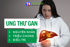 UNG THƯ GAN: NGUYÊN NHÂN, TRIỆU CHỨNG VÀ PHƯƠNG PHÁP ĐIỀU TRỊ