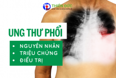 UNG THƯ PHỔI: NGUYÊN NHÂN, TRIỆU CHỨNG VÀ PHƯƠNG PHÁP ĐIỀU TRỊ