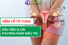 VIÊM CỔ TỬ CUNG: DẤU HIỆU VÀ CÁC PHƯƠNG PHÁP ĐIỀU TRỊ
