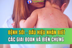 BỆNH SỞI: DẤU HIỆU NHẬN BIẾT, CÁC GIAI ĐOẠN VÀ BIẾN CHỨNG NGUY HIỂM