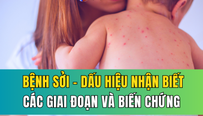 BỆNH SỞI: DẤU HIỆU NHẬN BIẾT, CÁC GIAI ĐOẠN VÀ BIẾN CHỨNG NGUY HIỂM