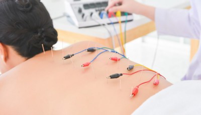 HIỆU QUẢ KHÔNG NGỜ CỦA CHÂM CỨU TRONG VIỆC ĐIỀU TRỊ VIÊM XƯƠNG KHỚP