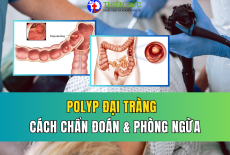 POLYP ĐẠI TRÀNG: CÁCH CHẨN ĐOÁN VÀ PHÒNG NGỪA