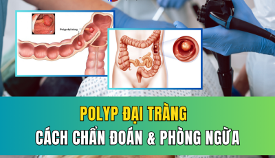 POLYP ĐẠI TRÀNG: CÁCH CHẨN ĐOÁN VÀ PHÒNG NGỪA