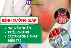 BỆNH CƯỜNG GIÁP: NGUYÊN NHÂN, TRIỆU CHỨNG VÀ CÁC PHƯƠNG PHÁP ĐIỀU TRỊ TIÊN TIẾN