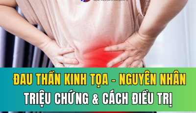 ĐAU THẦN KINH TỌA: NGUYÊN NHÂN, TRIỆU CHỨNG VÀ CÁC PHƯƠNG PHÁP ĐIỀU TRỊ