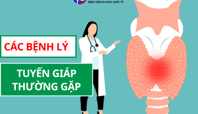 CÁC BỆNH LÝ TUYẾN GIÁP THƯỜNG GẶP: TỪ LÀNH TÍNH ĐẾN ÁC TÍNH