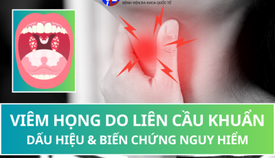 VIÊM HỌNG DO LIÊN CẦU KHUẨN: DẤU HIỆU VÀ NHỮNG BIẾN CHỨNG NGUY HIỂM