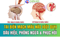 TAI BIẾN MẠCH MÁU NÃO (ĐỘT QUỴ): DẤU HIỆU CẢNH BÁO, PHÒNG NGỪA VÀ PHỤC HỒI SAU TAI BIẾN