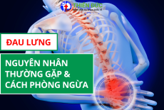 ĐAU LƯNG: NGUYÊN NHÂN THƯỜNG GẶP VÀ CÁCH PHÒNG NGỪA