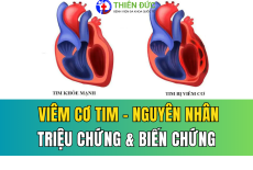 VIÊM CƠ TIM: NGUYÊN NHÂN, TRIỆU CHỨNG VÀ NHỮNG BIẾN CHỨNG NGUY HIỂM
