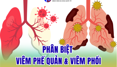 PHÂN BIỆT VIÊM PHẾ QUẢN VÀ VIÊM PHỔI: ĐỪNG ĐỂ SỰ NHẦM LẪN GÂY RA SỰ NGUY HIỂM