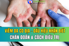 VIÊM DA CƠ ĐỊA: DẤU HIỆU NHẬN BIẾT, CHẨN ĐOÁN VÀ CÁC PHƯƠNG PHÁP ĐIỀU TRỊ