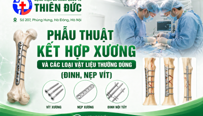 PHẪU THUẬT KẾT HỢP XƯƠNG LÀ GÌ? CÁC LOẠI VẬT LIỆU THƯỜNG DÙNG (ĐINH, NẸP VÍT)