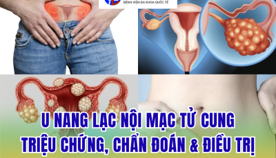 U NANG LẠC NỘI MẠC TỬ CUNG: TRIỆU CHỨNG, CHẨN ĐOÁN VÀ CÁCH ĐIỀU TRỊ HIỆU QUẢ