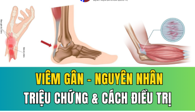 VIÊM GÂN: NGUYÊN NHÂN, TRIỆU CHỨNG VÀ CÁCH ĐIỀU TRỊ