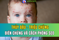 THỦY ĐẬU: TRIỆU CHỨNG, BIẾN CHỨNG VÀ CÁCH PHÒNG NGỪA SẸO