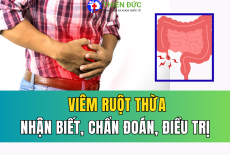 VIÊM RUỘT THỪA: DẤU HIỆU NHẬN BIẾT, CHẨN ĐOÁN VÀ PHƯƠNG PHÁP ĐIỀU TRỊ