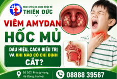 VIÊM AMIDAN HỐC MỦ - DẤU HIỆU, CÁCH ĐIỀU TRỊ VÀ KHI NÀO CÓ CHỈ ĐỊNH CẮT?