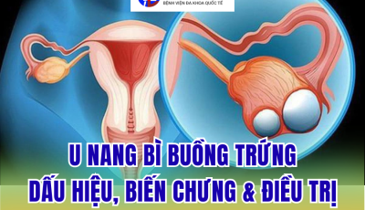 U NANG BÌ BUỒNG TRỨNG: DẤU HIỆU NHẬN BIẾT, NGUY CƠ BIẾN CHỨNG VÀ CÁCH ĐIỀU TRỊ