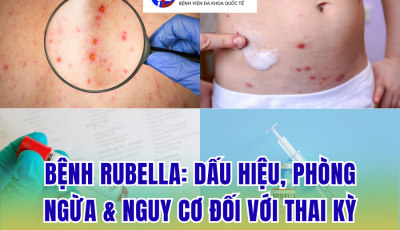 BỆNH RUBELLA: DẤU HIỆU, CÁCH PHÒNG NGỪA VÀ NGUY CƠ ĐỐI VỚI THAI KỲ