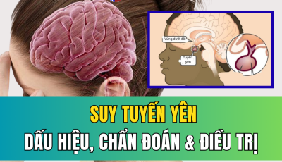 SUY TUYẾN YÊN: DẤU HIỆU NHẬN BIẾT, CHẨN ĐOÁN VÀ PHƯƠNG PHÁP ĐIỀU TRỊ